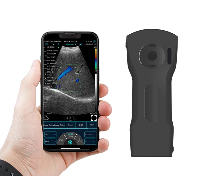 FirstMed C10XS 3 in 1 Dual-Probes Multipurpose Ultrasound Convex + Linear Probe