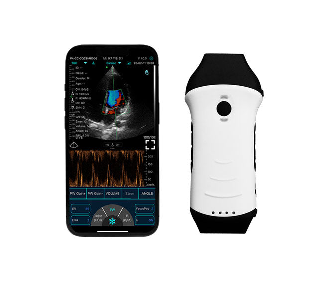 Handheald Ultrasound or scaner probe wireless Model C10HL Dual : Phased + Linear Firstmedcorp.us