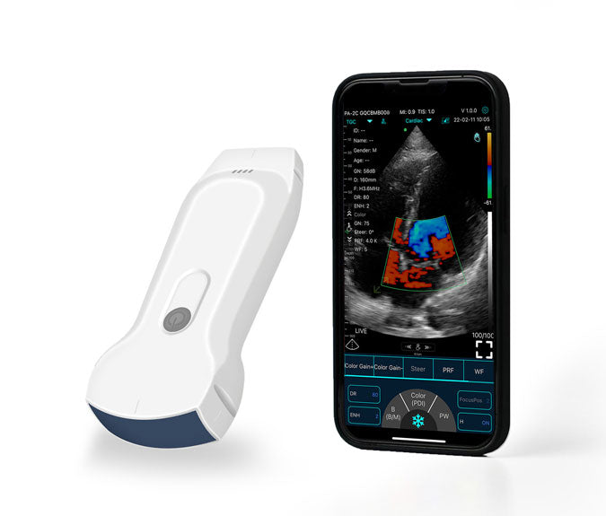 FirstMed C10RL Dual-Probes Multipurpose Ultrasound Convex + Linear + Cardiac Probe