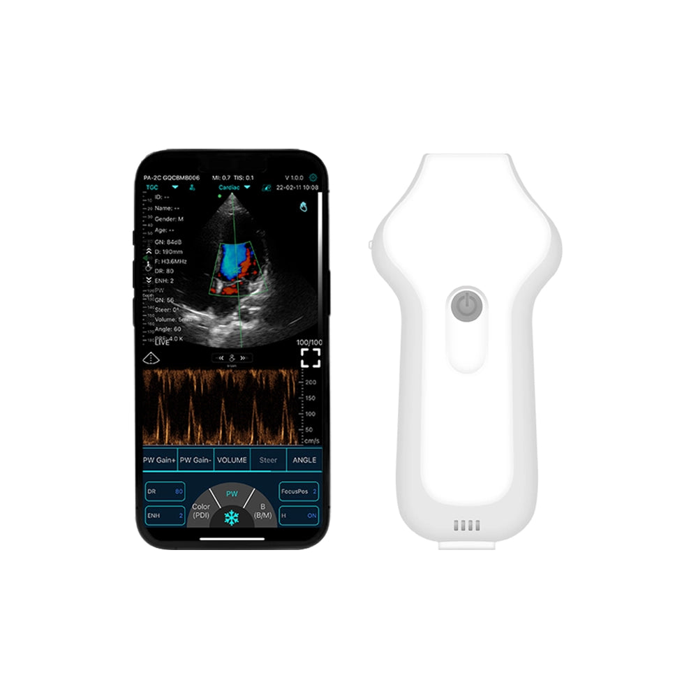 FirstMed C10UC USB&Wifi Cardiac Ultrasound Probe