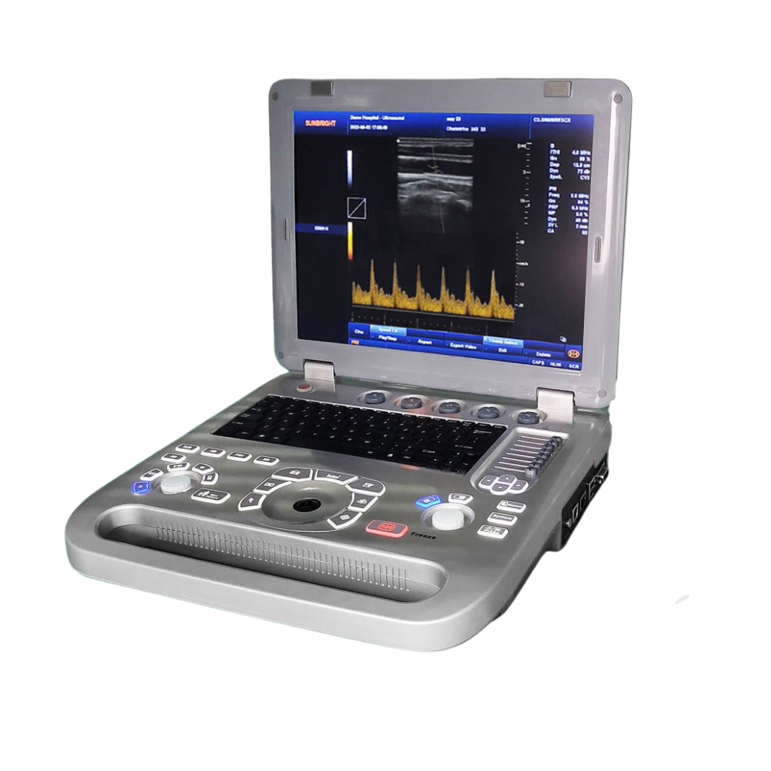 Excellent Quality Portable B/W Ultrasound Machine Doppler Ultrasound Machine FMED-800F1  With two probe and Simpsons method.