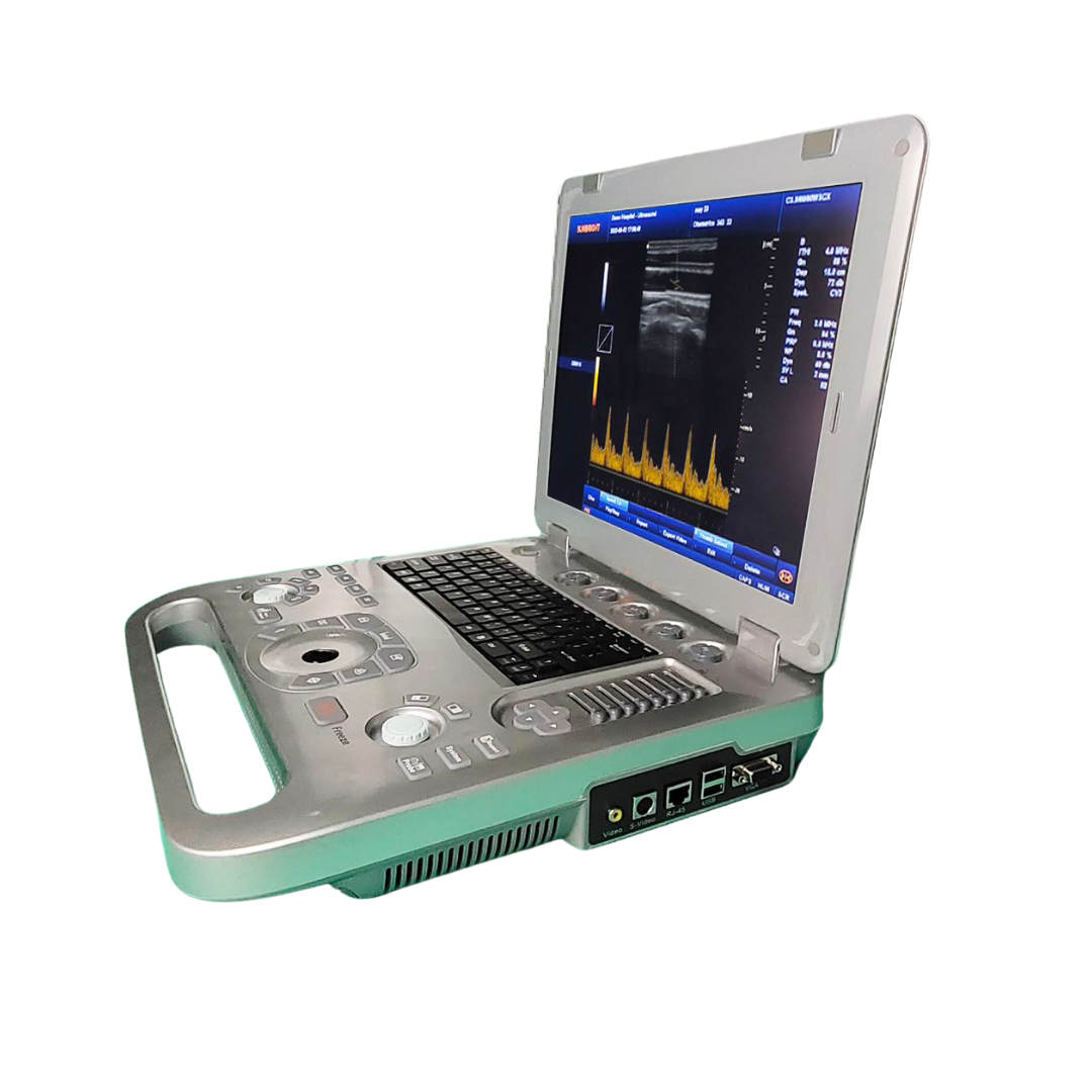 Excellent Quality Portable B/W Ultrasound Machine Doppler Ultrasound Machine FMED-800F1  With two probe and Simpsons method.
