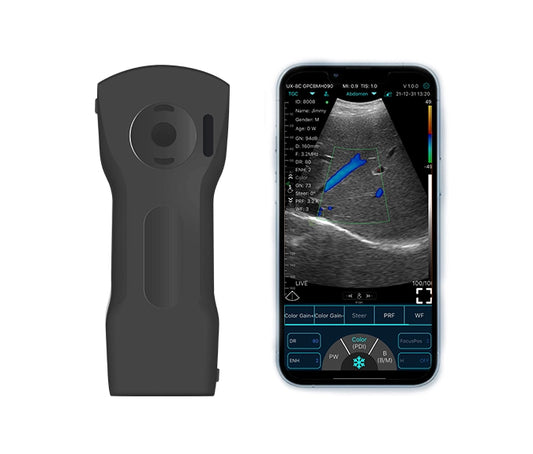 FirstMed C10XS 3 in 1 Dual-Probes Multipurpose Ultrasound Convex + Linear Probe