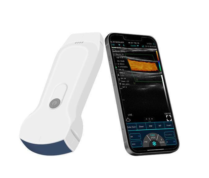 FirstMed C10RL Dual-Probes Multipurpose Ultrasound Convex + Linear + Cardiac Probe
