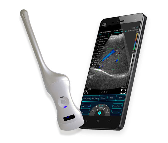 Handheald Ultrasound or scaner probe wireless C10QT Dual-Probes Multipurpose Ultrasound Convex + Endocavity + Cardiac Probe / Frequency 3.5-5Mhz,2.5-5Mhz, 6-8Mhz FirstMedcorp.us