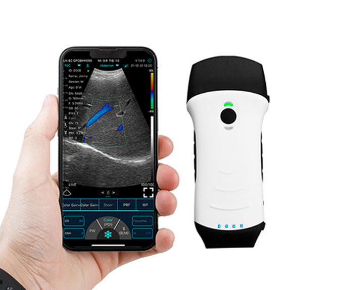 Handheald Ultrasound or scaner probe wireless C10TX Dual-probes Multipurpose  Convex + linear + Cardiac / Frequency 3.2/5Mhz , 7.5/I0Mhz ，2.5/5MhzFirstMedcorp.us