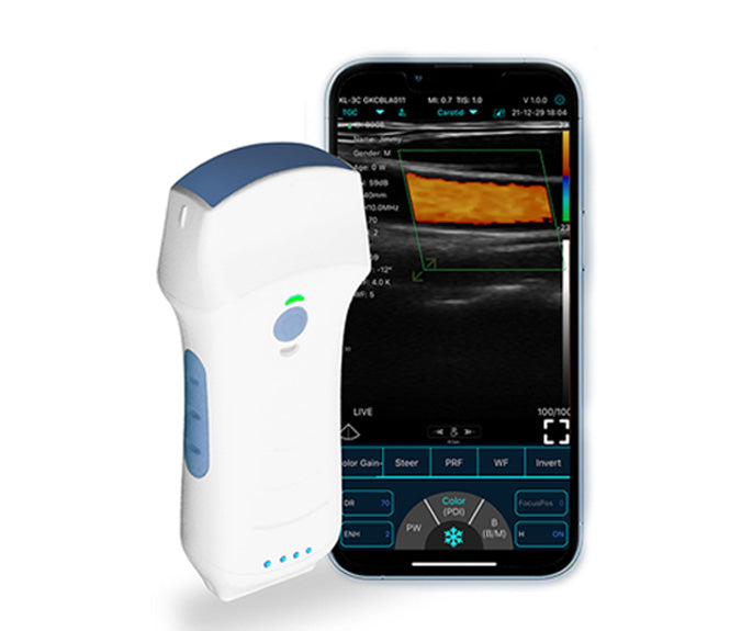 Handheald Ultrasound or scaner probe wireless C10TX Dual-probes Multipurpose  Convex + linear + Cardiac / Frequency 3.2/5Mhz , 7.5/I0Mhz ，2.5/5MhzFirstMedcorp.us