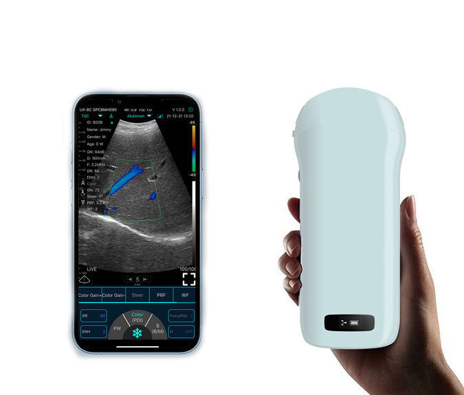 FirstMed C10T One-Probe Multipurpose Ultrasound Convex+ Linear+ Cardiac Probe