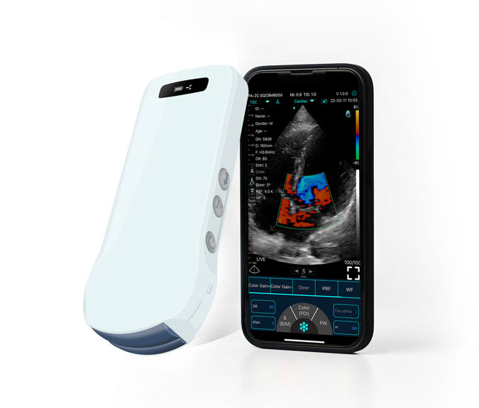 FirstMed C10T One-Probe Multipurpose Ultrasound Convex+ Linear+ Cardiac Probe