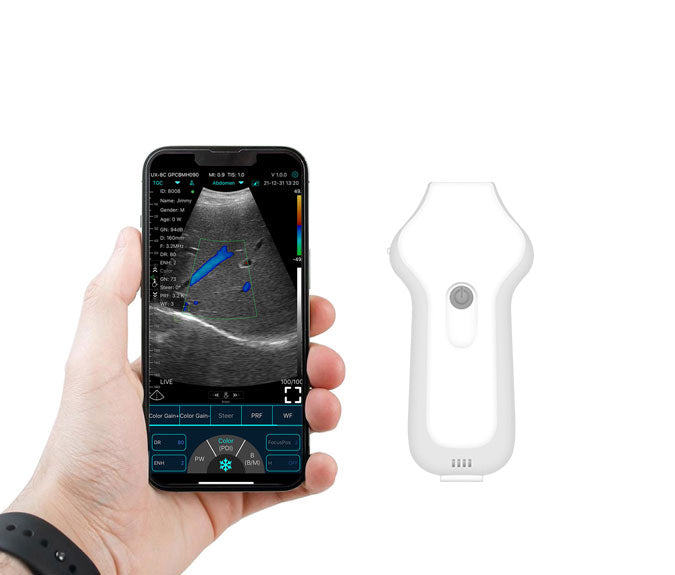 FirstMed C10UC USB&Wifi Cardiac Ultrasound Probe